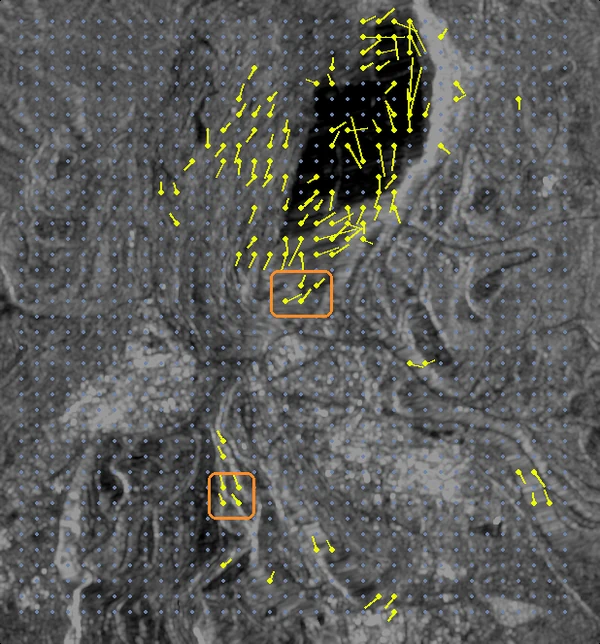 Imagen de radar de la zona minera de Chuquicamata con nodos de seguimiento, flechas de desplazamiento y dos alertas marcadas con recuadros